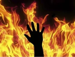 TRAGIS! SISWA SD DI SITUBONDO TERBAKAR HIDUP-HIDUP DIDUGA AKIBAT ULAH EMPAT TEMANNYA, POLISI TURUN TANGAN