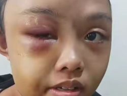 Gadis Yatim Piatu di Kampar Jadi Korban Kekerasan Tante, Tidur di Gudang Tanpa Alas dan Disiksa Setiap Hari