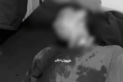 TAWURAN BRUTAL DI JONGGOL: REMAJA ALAMI LUKA SERIUS DI KEPALA AKIBAT SABETAN SENJATA TAJAM