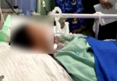 Bocah 12 Tahun Asal Pekalongan Meninggal Dunia Usai Digigit Ular Weling Saat Tidur