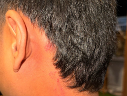 Remaja di Sumenep Diduga Jadi Korban Penganiayaan Brutal, Pelaku Dilaporkan ke Polres Sumenep dengan Pasal Perlindungan Anak